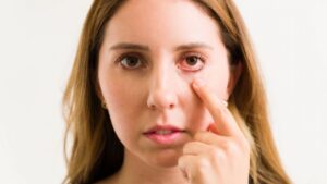 tipos de conjutivite