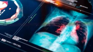 dia mundial da pneumonia