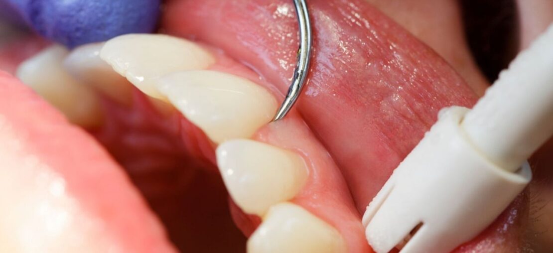 periodontia