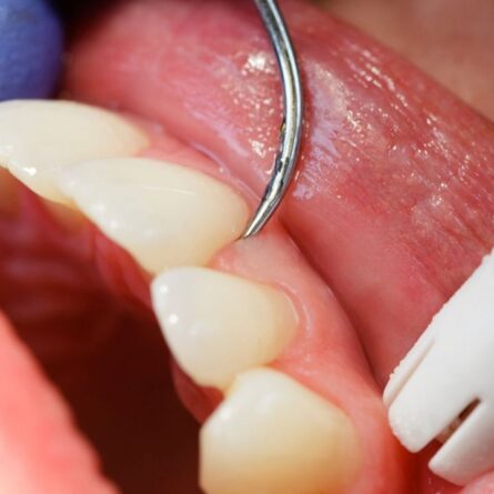 periodontia