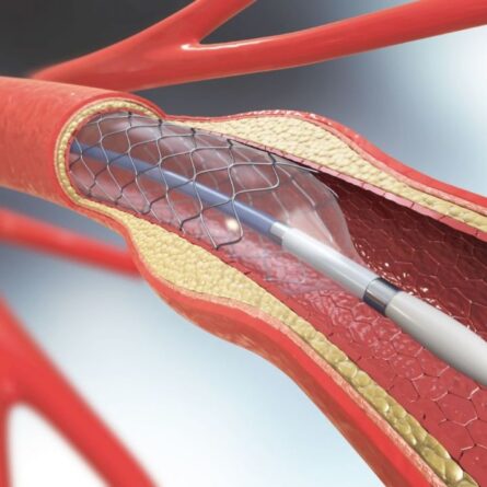 cardiologia bariátrica