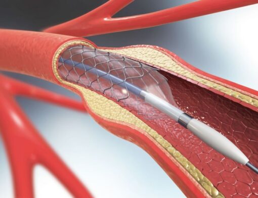 cardiologia bariátrica