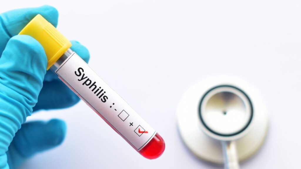 sifilis