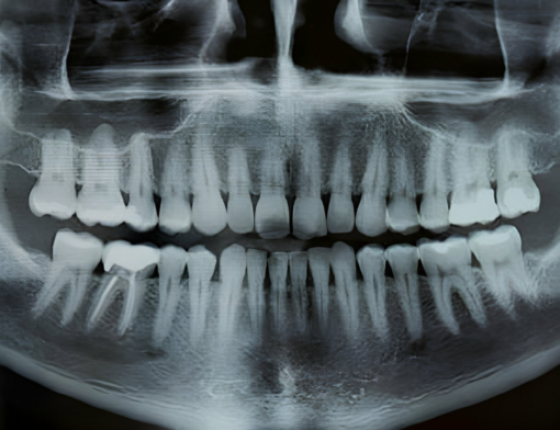 Imagem emitida por um exame de raio x panorâmico odontológico/ (raio x panorâmico valor)