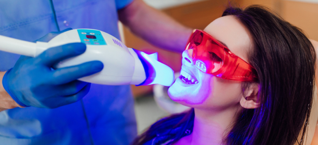 Um dentista realizando aplicação de clareamento dental a laser em uma paciente no consultório odontológico.