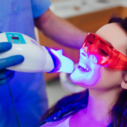 Um dentista realizando aplicação de clareamento dental a laser em uma paciente no consultório odontológico.