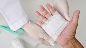 Um médico realizando curativo em ferida infeccionada de paciente.