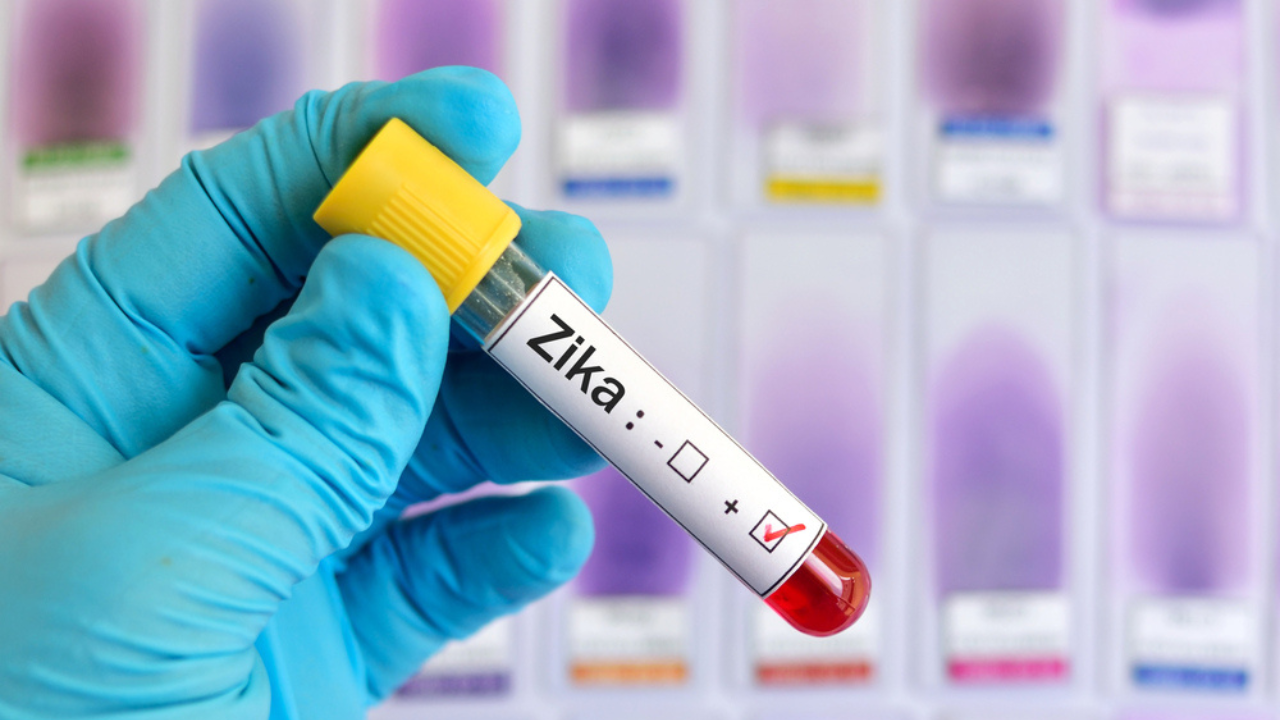 Um exame de sangue com diagnóstico positivo para Zika.