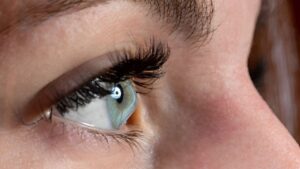 Foco em olho de mulher com ceratocone