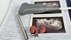 Estrutura de rins sobre resultado de exame de cisto nos rins