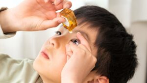 Criança pingando colírio para conjuntivite infantil