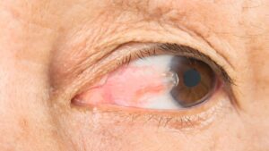 Zoom em olho com pele