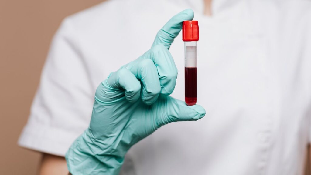 Diarreia com sangue: veja o que pode ser! - Blog AmorSaúde