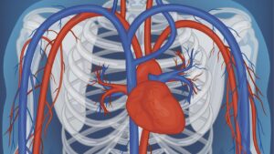 Prevenção de uma veia estourada