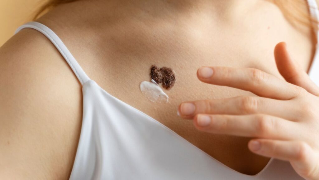 Principais cuidados durante o Dezembro Laranja