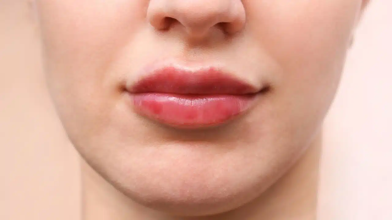 Quando buscar ajuda médica para ferida na boca Quando buscar ajuda médica para ferida na boca