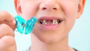 Aparelho para céu da boca