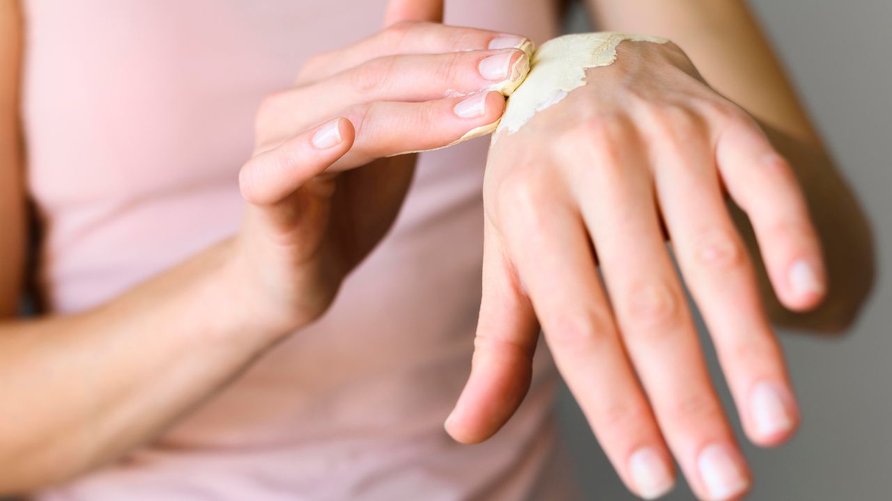 Mancha amarela na pele