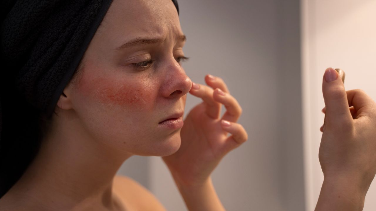 O que pode ser mancha amarela na pele