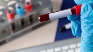 Como saber qual meu tipo sanguíneo