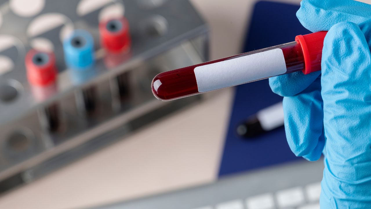 Onde fazer exame de sangue com segurança