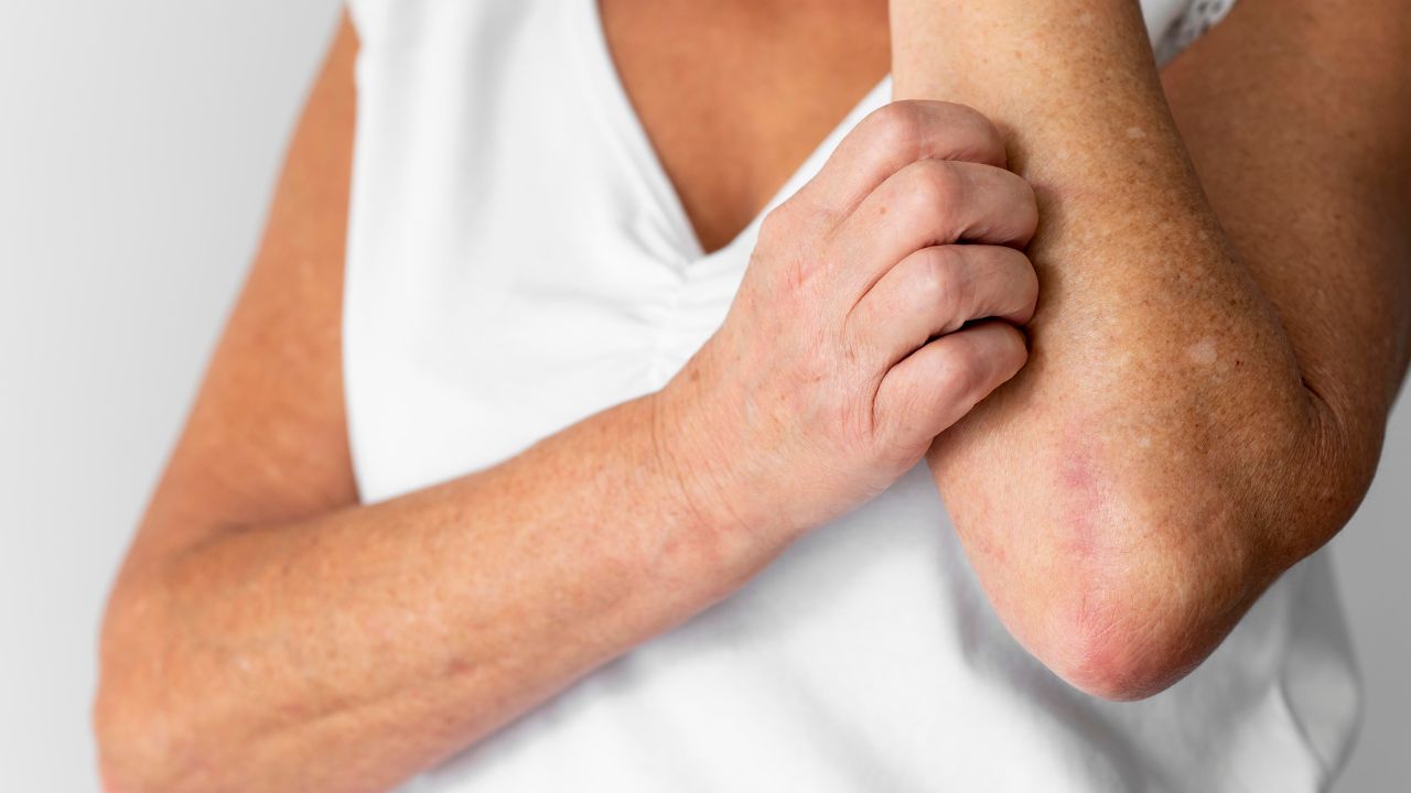 bolinha nos braços bolinha nos braços