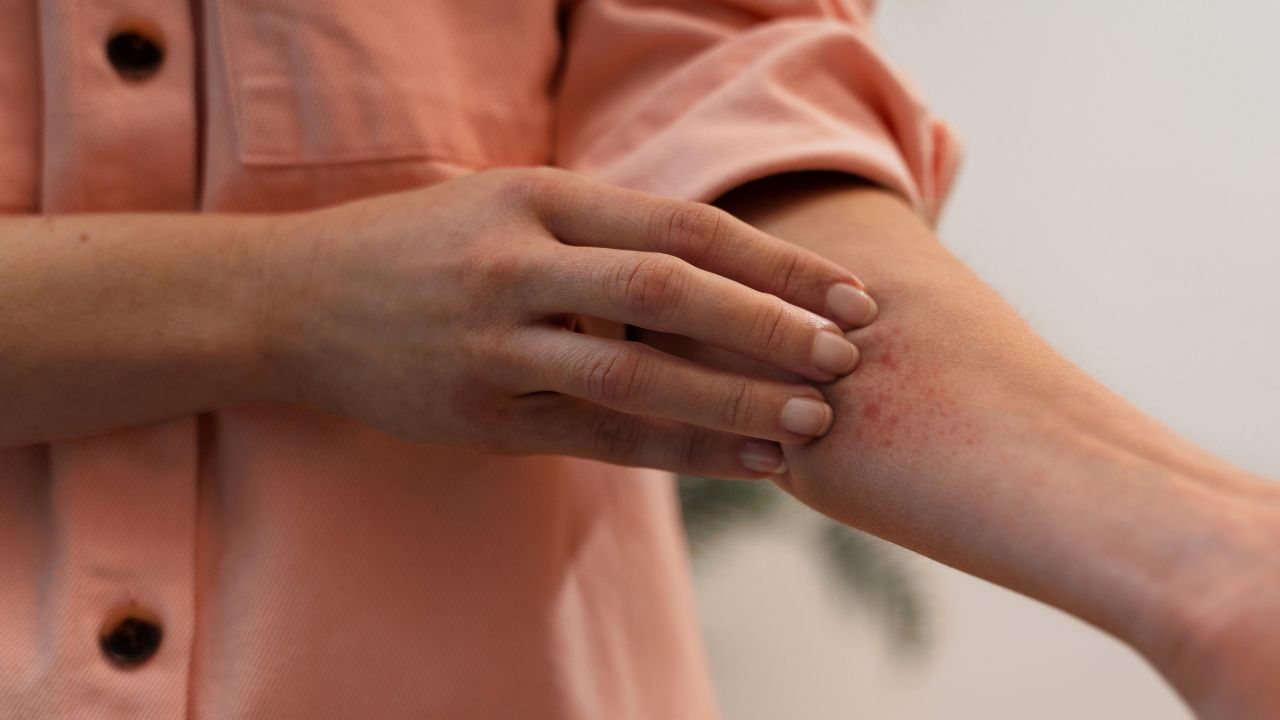 bolinhas vermelhas nos braços bolinhas vermelhas nos braços