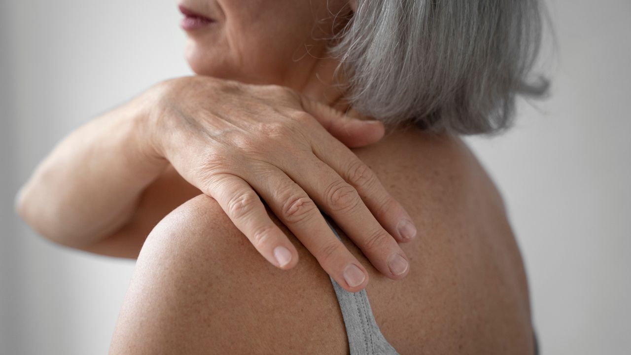 tratamentos para queratose pilar tratamentos para queratose pilar