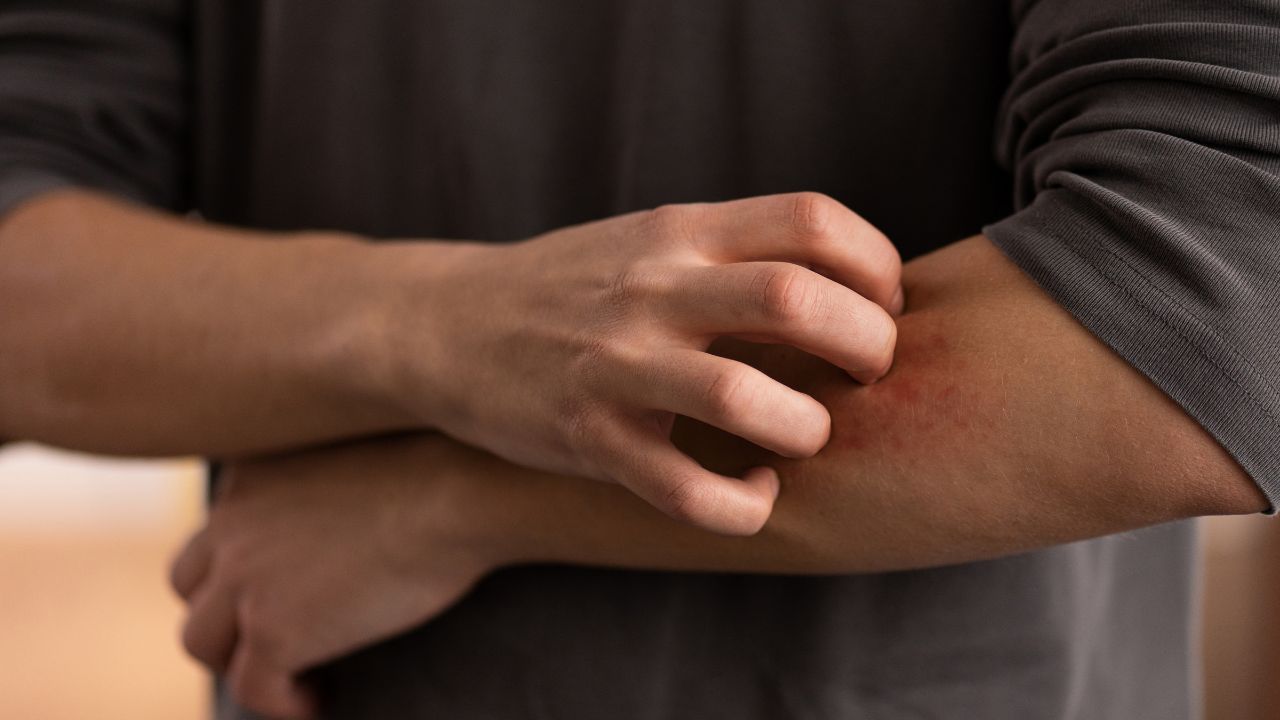 Principais causas de coceira no corpo