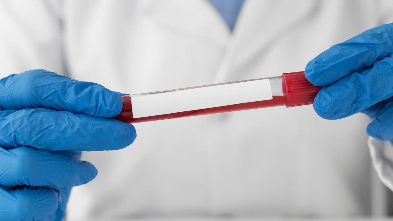 Sintomas que podem acompanhar um hemograma alterado Sintomas que podem acompanhar um hemograma alterado