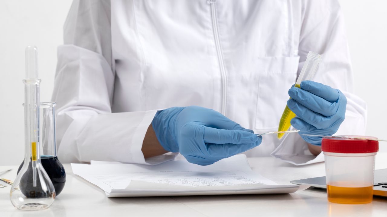 Como coletar a urina corretamente Como coletar a urina corretamente