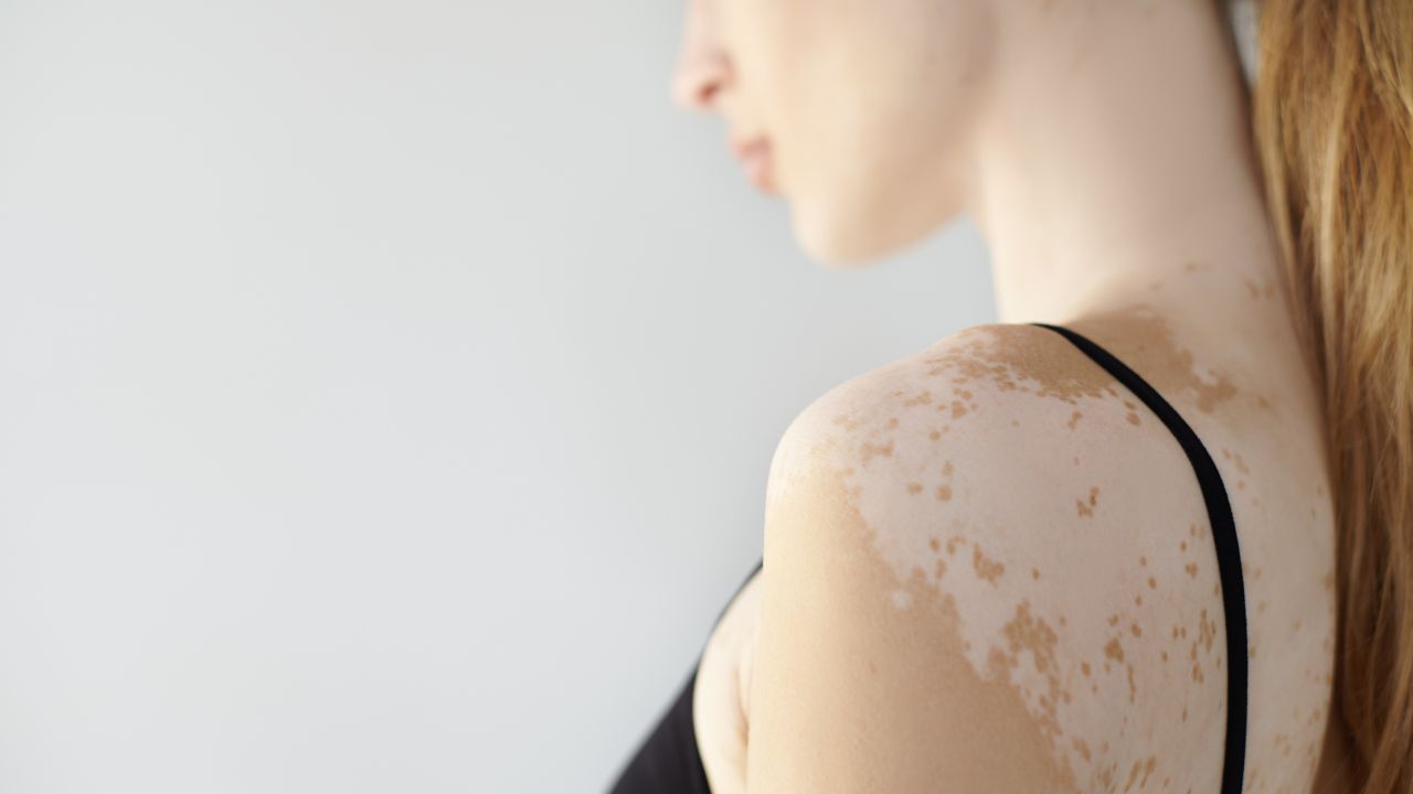 Como é feito o diagnóstico pelo dermatologista Como é feito o diagnóstico pelo dermatologista