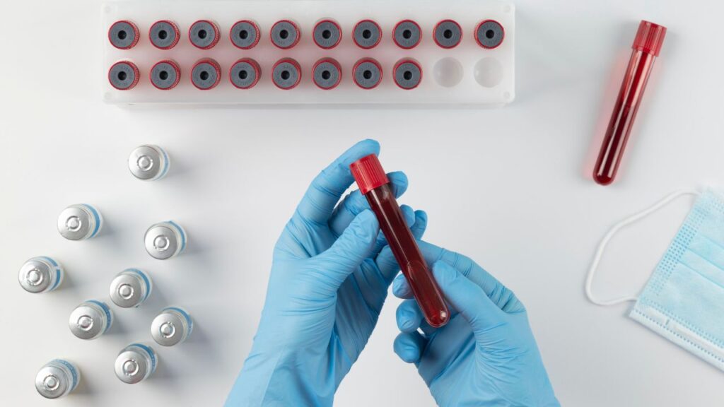 Exame de sangue completo: para que serve e o que ele detecta