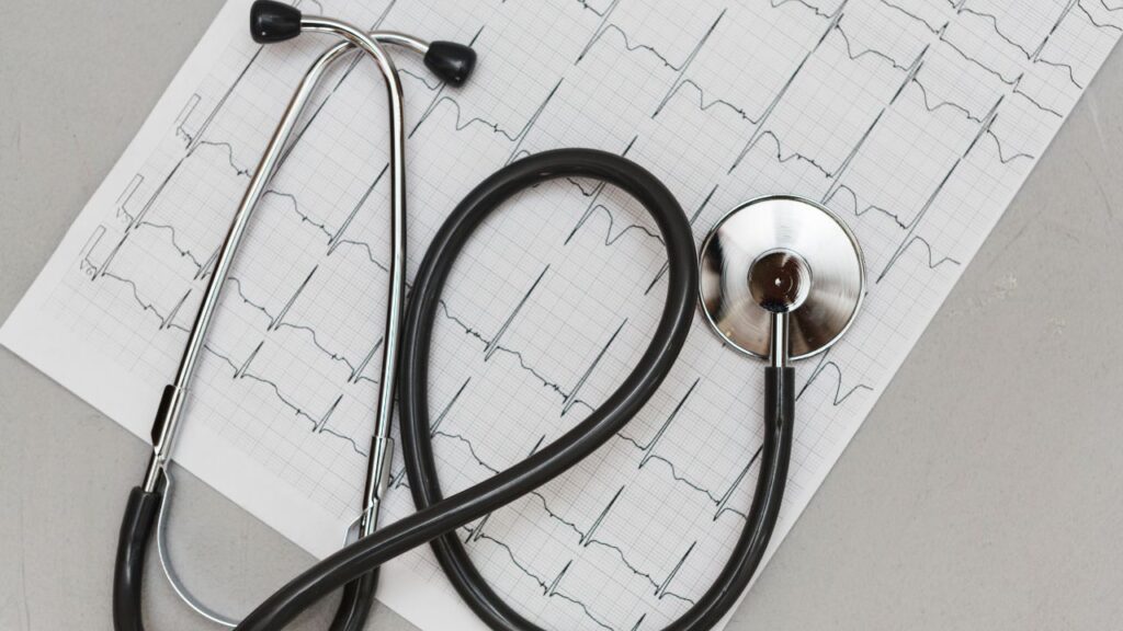 Eletrocardiograma
