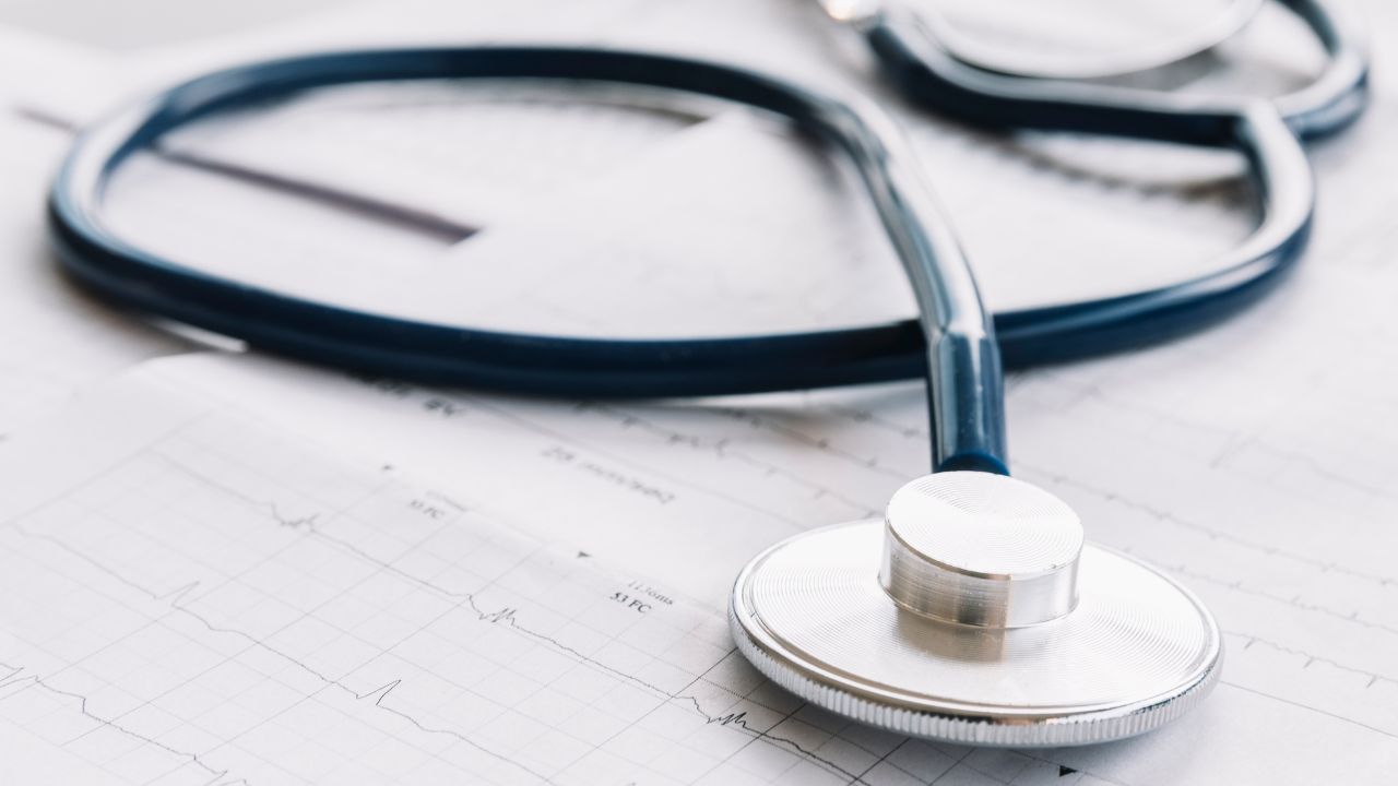 Perguntas frequentes sobre eletrocardiograma Perguntas frequentes sobre eletrocardiograma