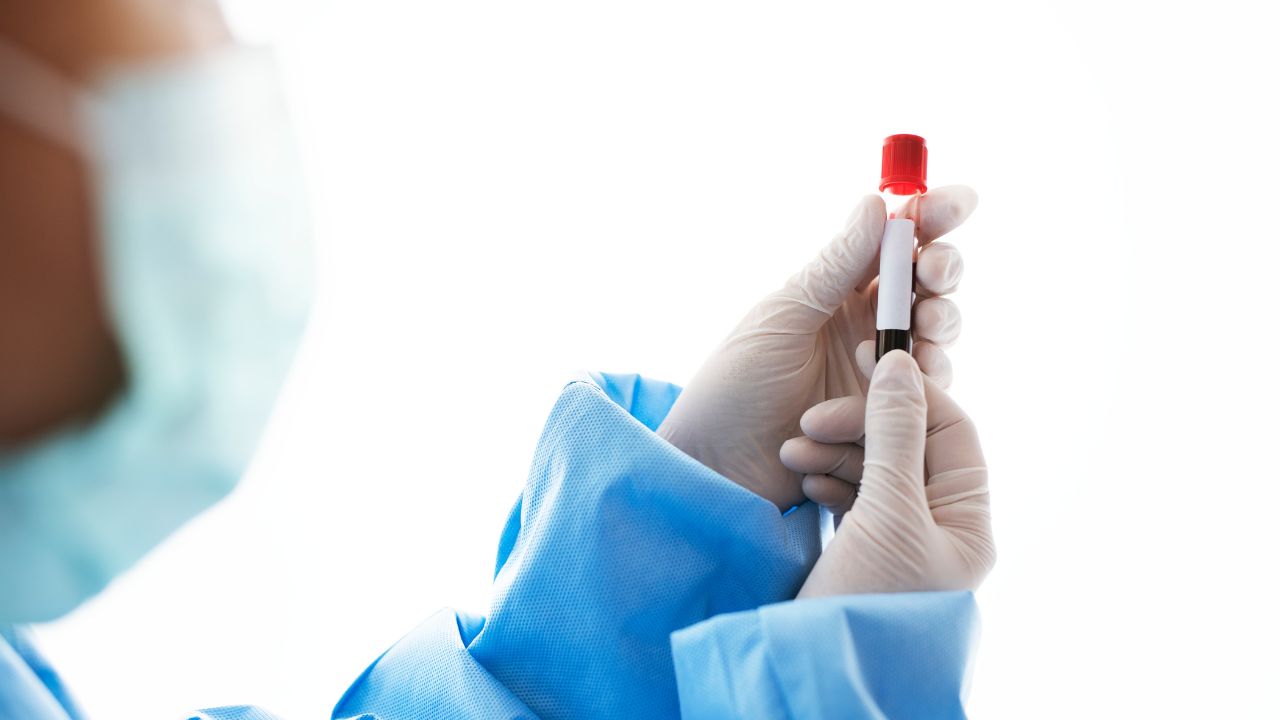 Perguntas frequentes sobre exame de sangue completo Perguntas frequentes sobre exame de sangue completo