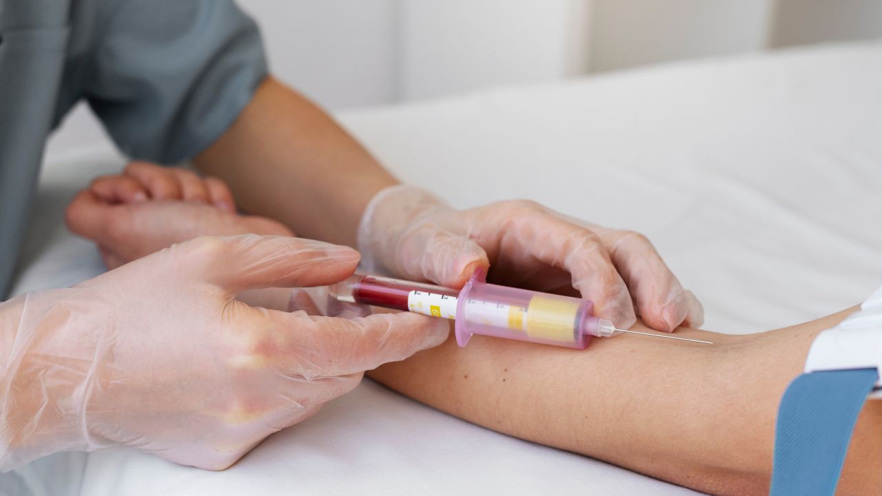 Plaquetograma_ coagulação e sangramento Plaquetograma_ coagulação e sangramento