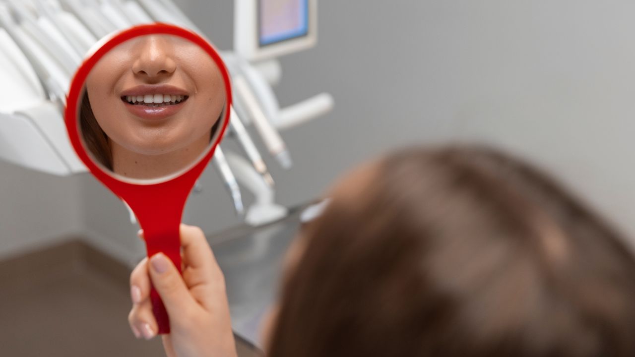 Perguntas frequentes sobre clareamento dental Perguntas frequentes sobre clareamento dental