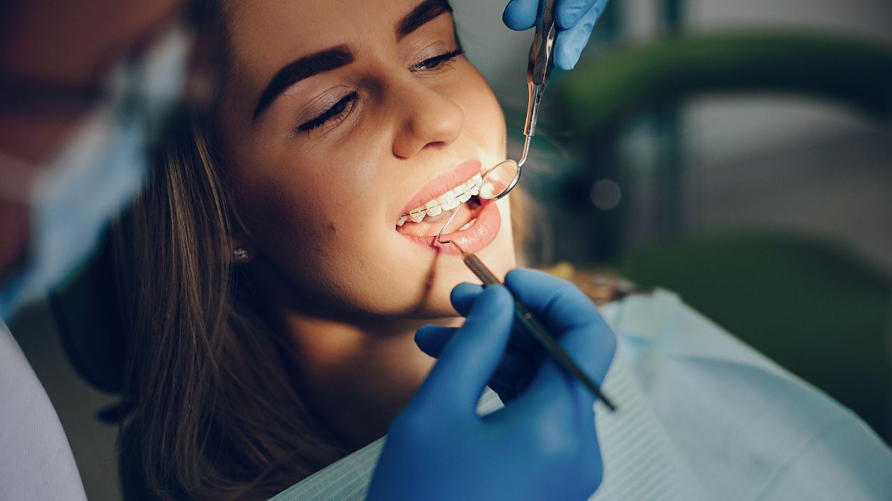 Qual a melhor idade para colocar aparelho Qual a melhor idade para colocar aparelho