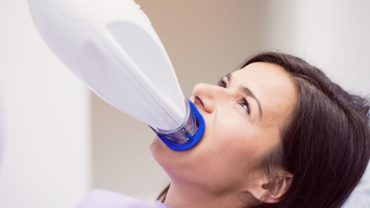 Quanto tempo dura o clareamento dental_ Guia para um sorriso branco Quanto tempo dura o clareamento dental_ Guia para um sorriso branco