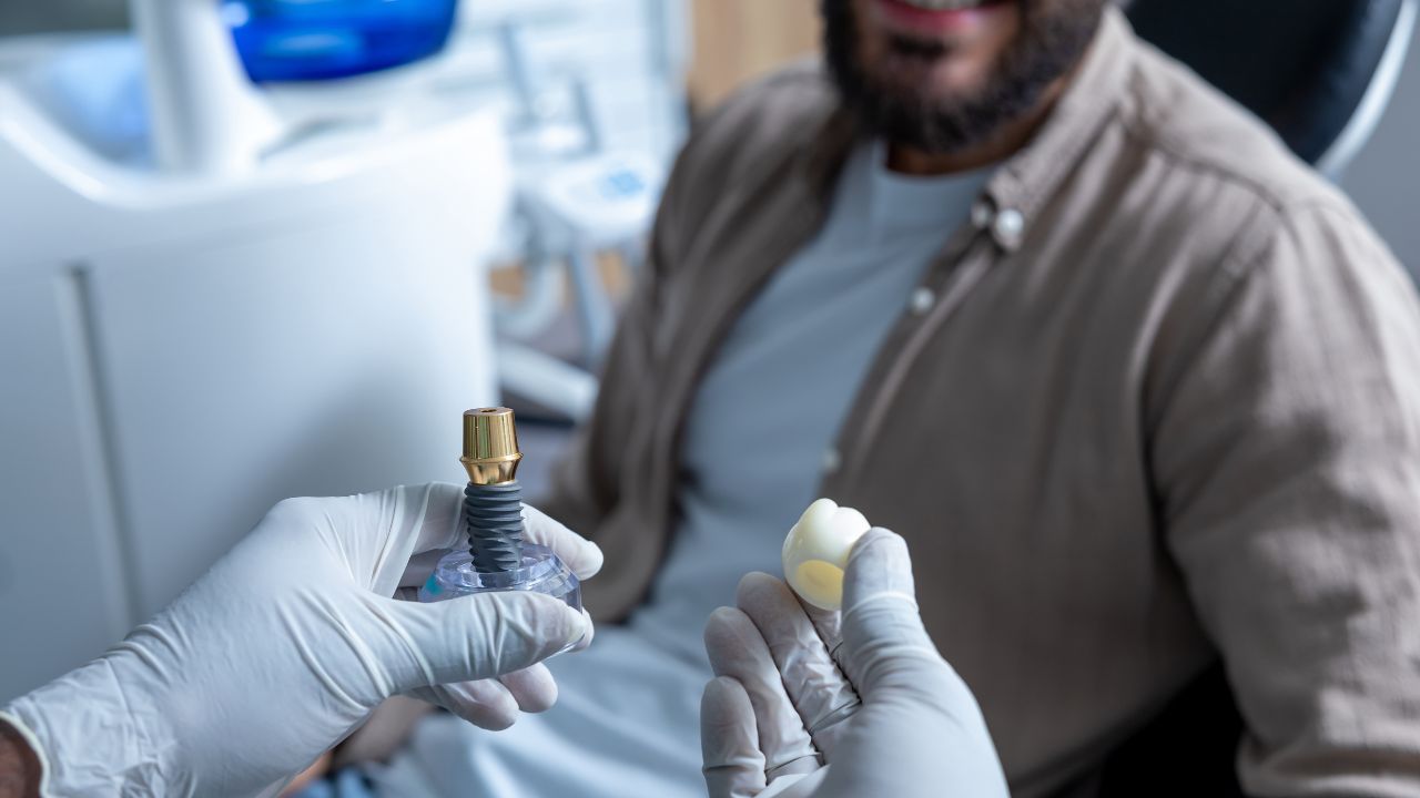 principais tipos de implante dentário