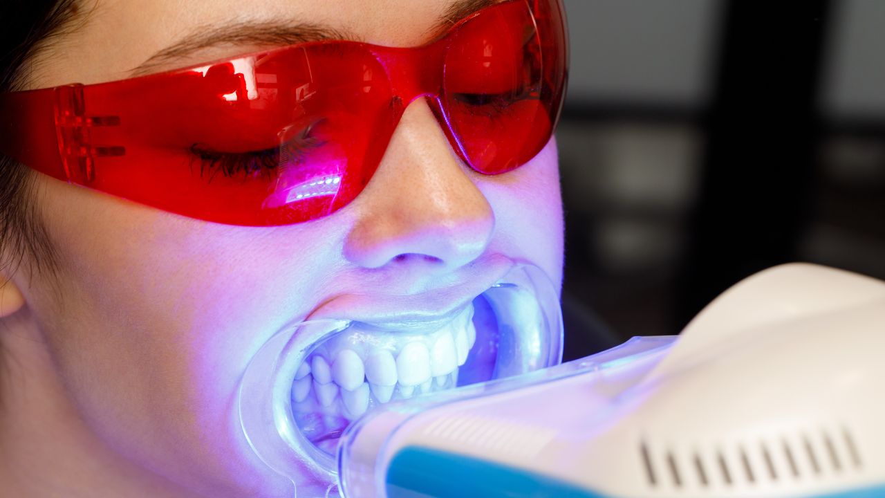 Clareamento dental dói