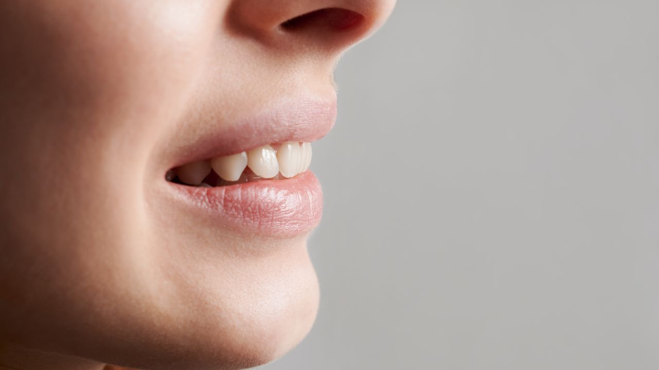 Por que a limpeza dental faz diferença antes do clareamento