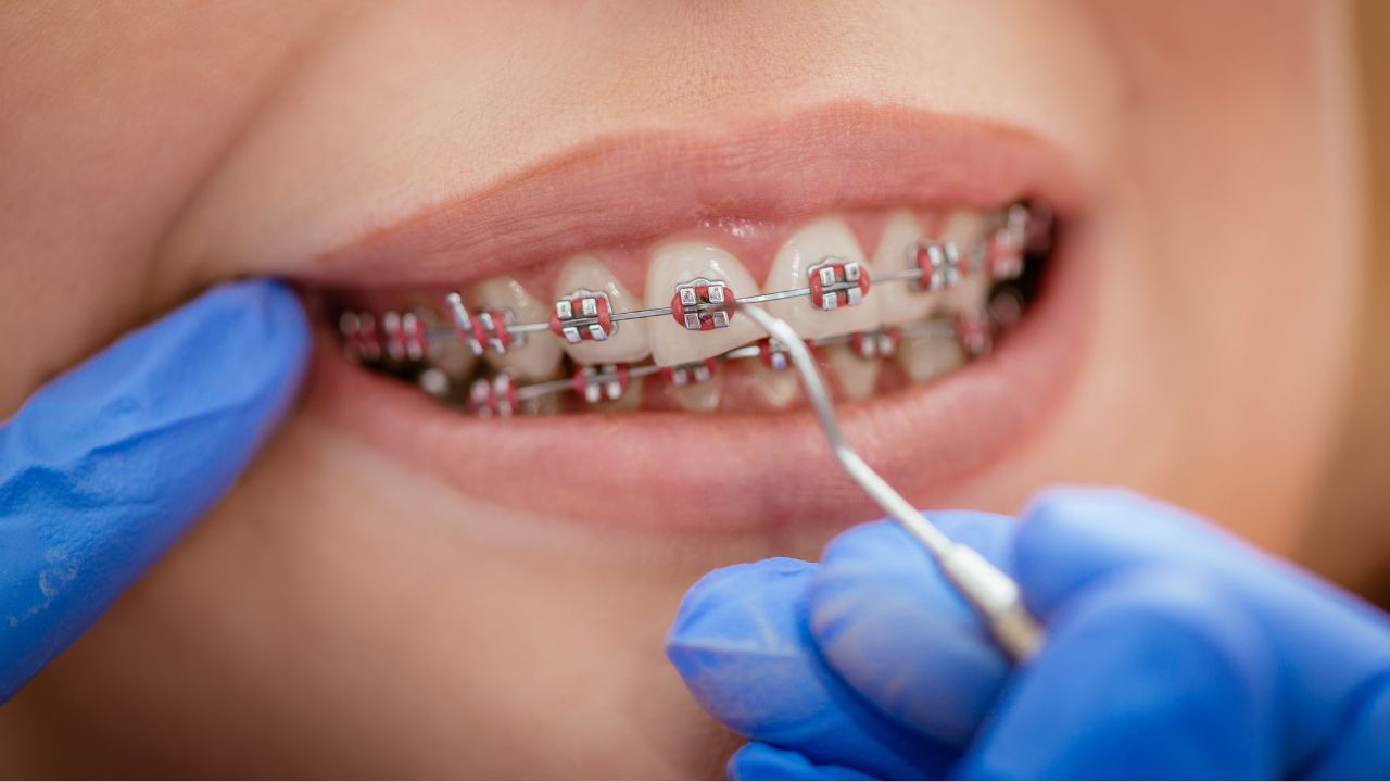 Ortodontia não é só estética