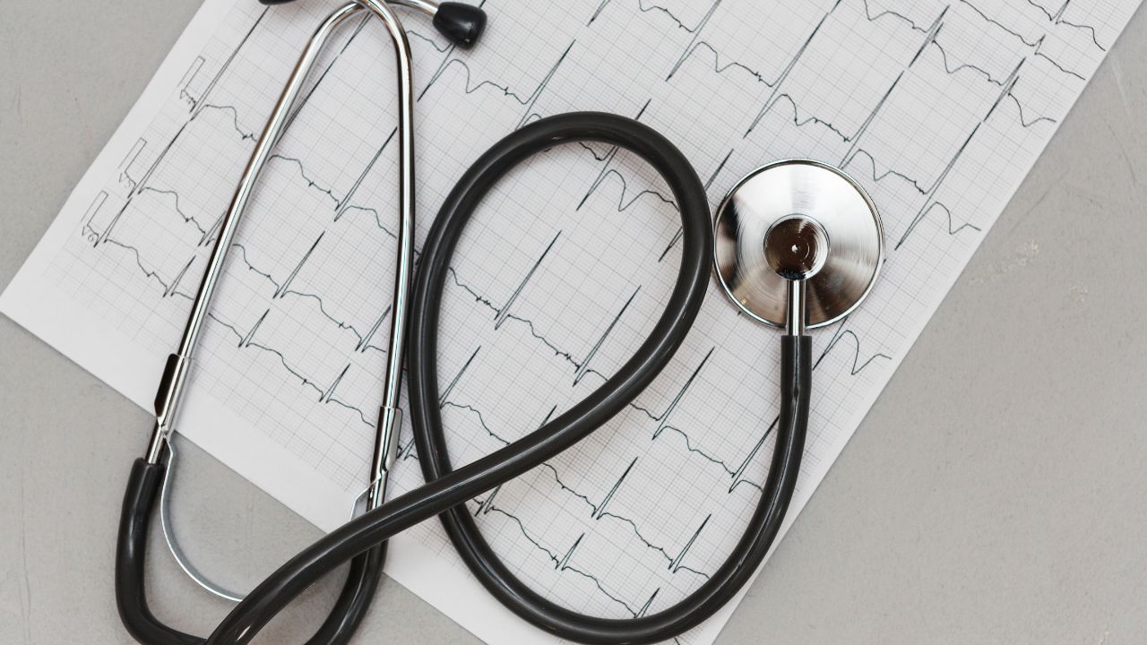 Termos técnicos mais comuns no laudo do ECG
